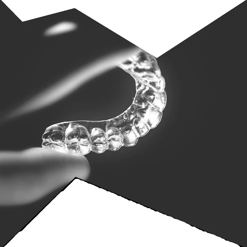Orthodontie invisible par aligneurs